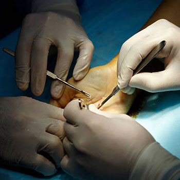 Hand & Microsurgery Hospital Gudivada
